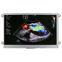 nhd-70-hdmi-n-rsxp NEWHAVEN DISPLAY INTERNATIONAL NHD-7.0-HDMI-N-RSXP IPS TFT TFT LCD Display / Touch Screen, 7in, 800 x 480pixels